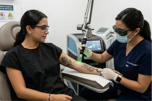 Tratamiento de eliminación de tatuajes con láser