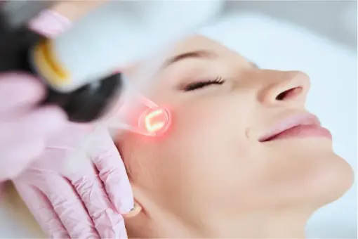 Rejuvenecimiento facial no ablativo con láser