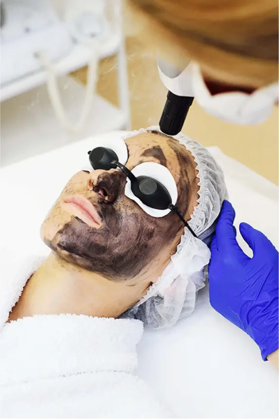 Hollywood Peel
